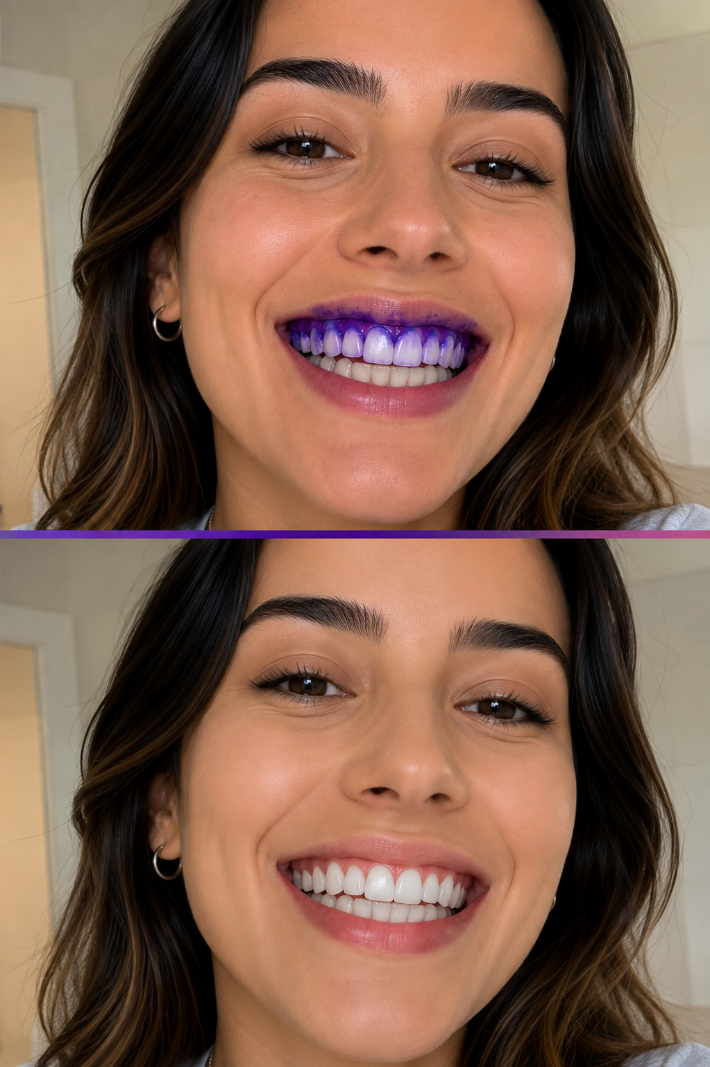 Tiras Blanqueadoras Dentales – Sonrisa Blanca en Casa