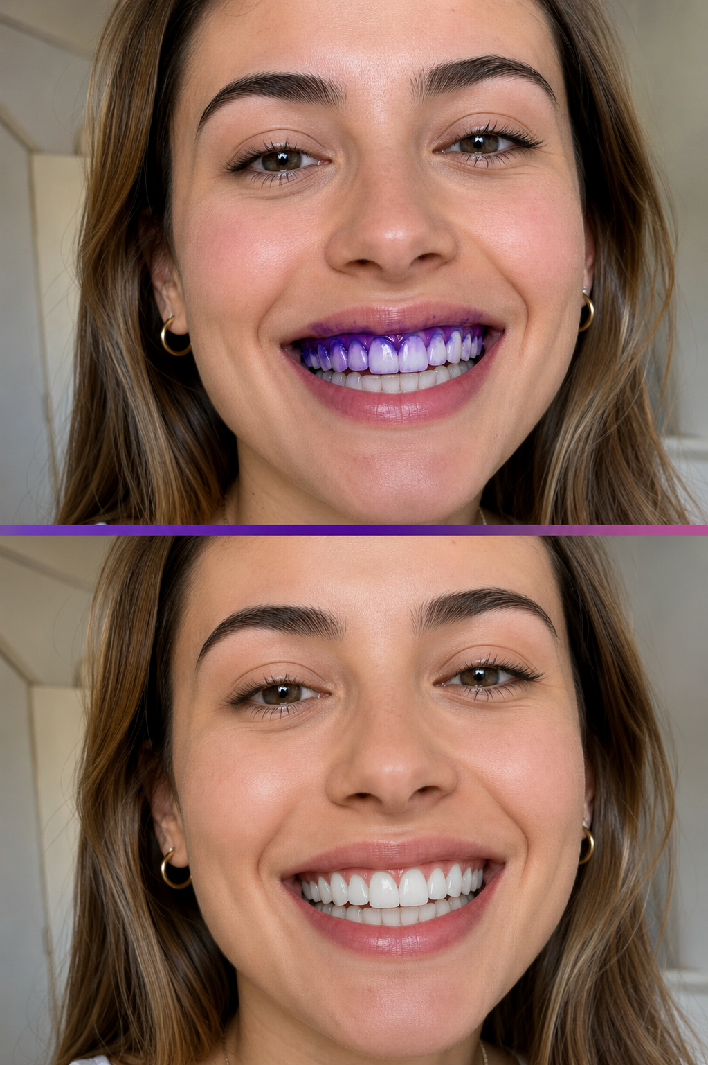 Tiras Blanqueadoras Dentales – Sonrisa Blanca en Casa