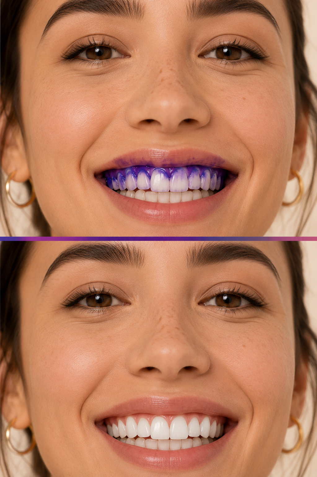 Tiras Blanqueadoras Dentales – Sonrisa Blanca en Casa